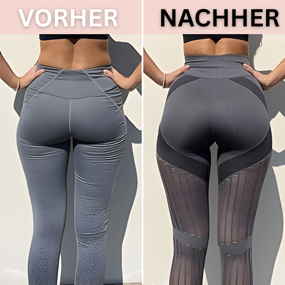 Clara™ - Anti Cellulite Leggings