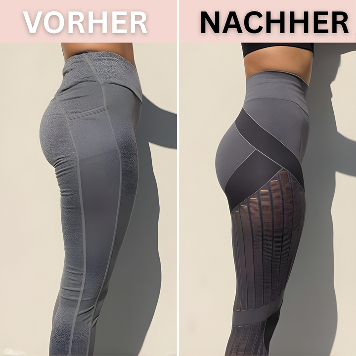 Clara™ - Anti Cellulite Leggings